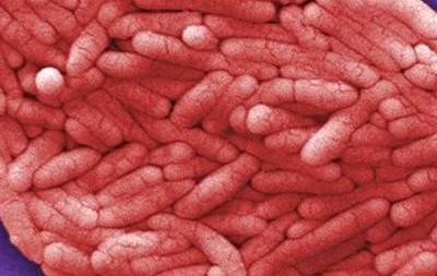 Cargill recalls 36 million pounds of contaminated ground meat in the US after one person dies and at least 80 others badly sickened-image